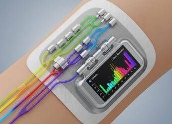 Diagnosi del Parkinson: sviluppato un cerotto indossabile per il monitoraggio dei biomarcatori